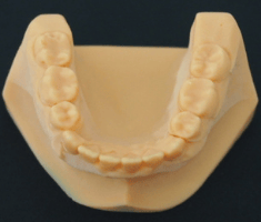 Slider image (3) GNUX Dental